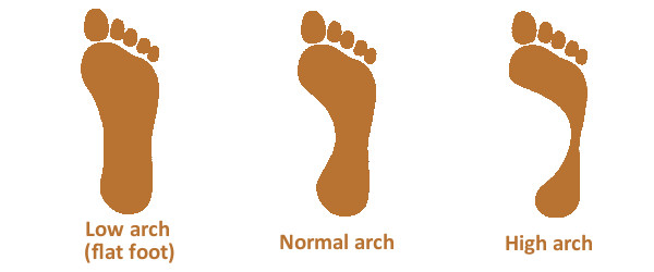 low arch foot