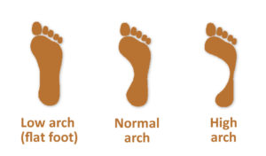 low arch vs high arch feet